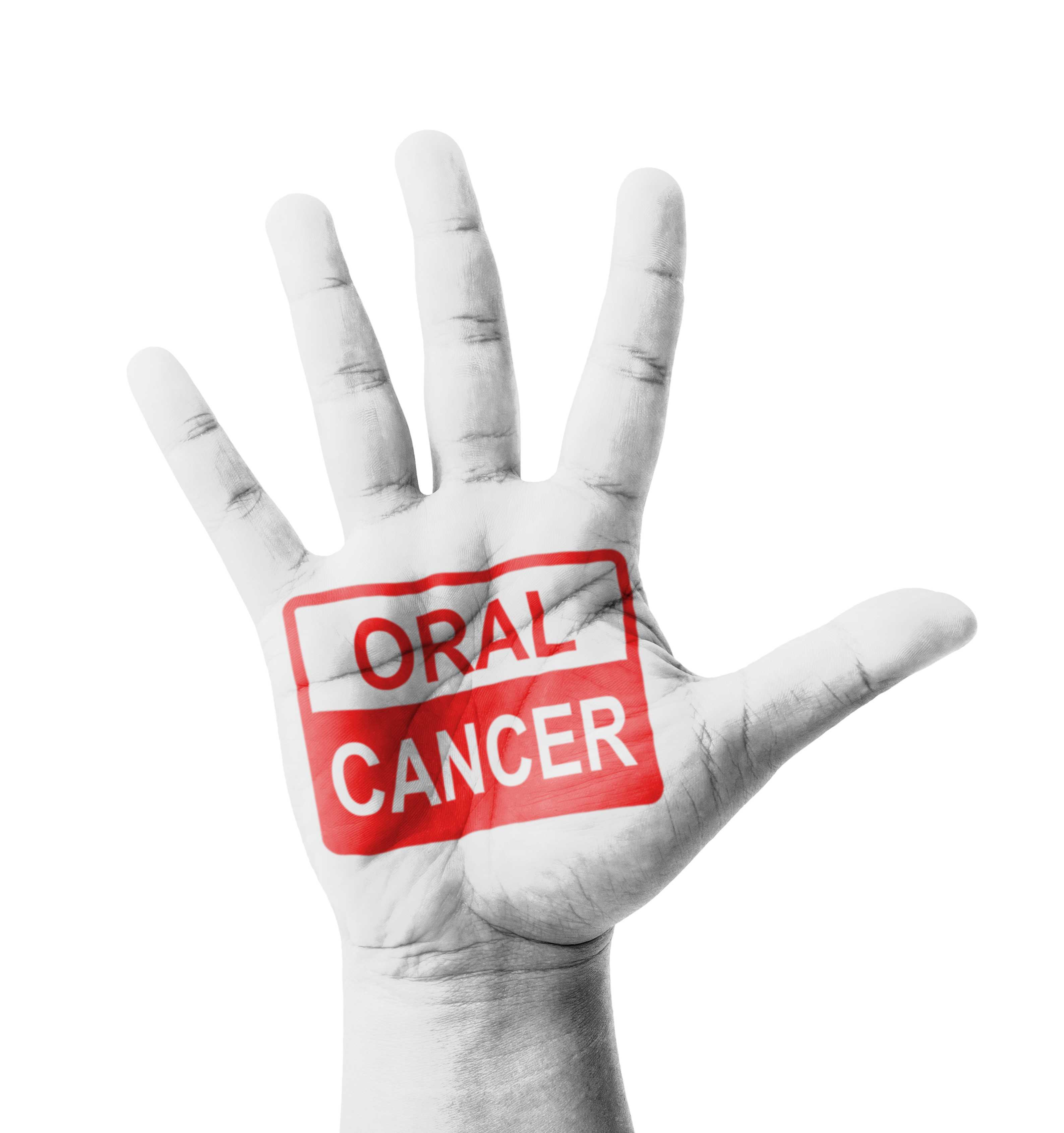 HPV-Related Oral Cancer is on the Rise in American Men
