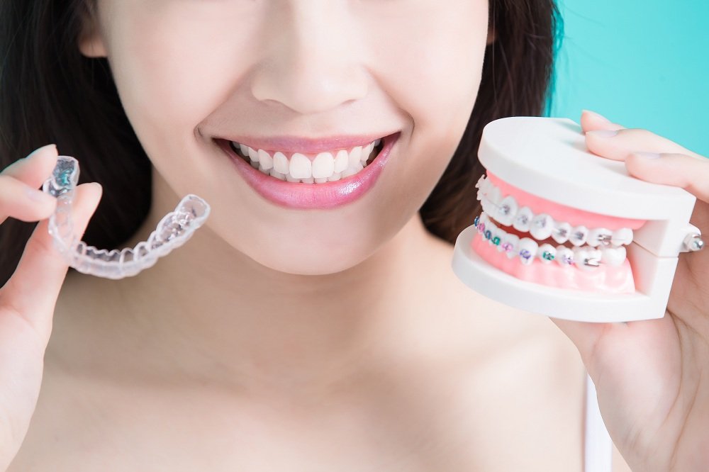 a woman with her Invisalign